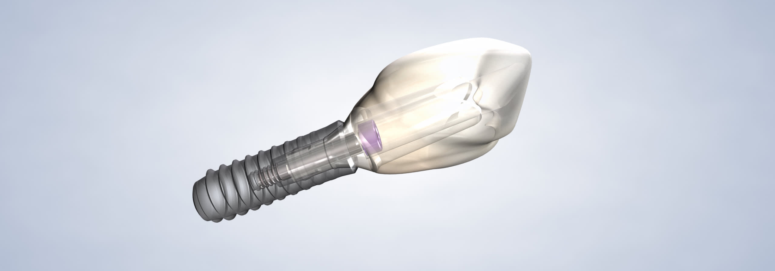 procedure  dental implants  desktop